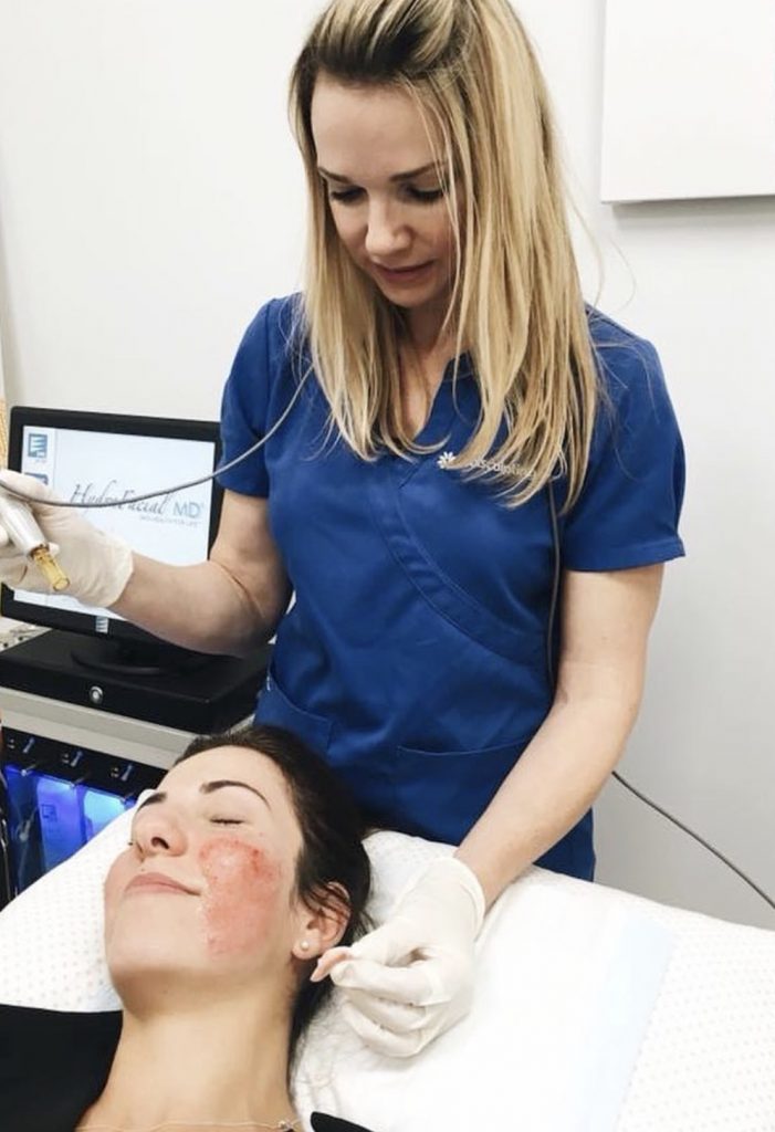 skin needling cottesloe - skin needling perth - skin needling for scars