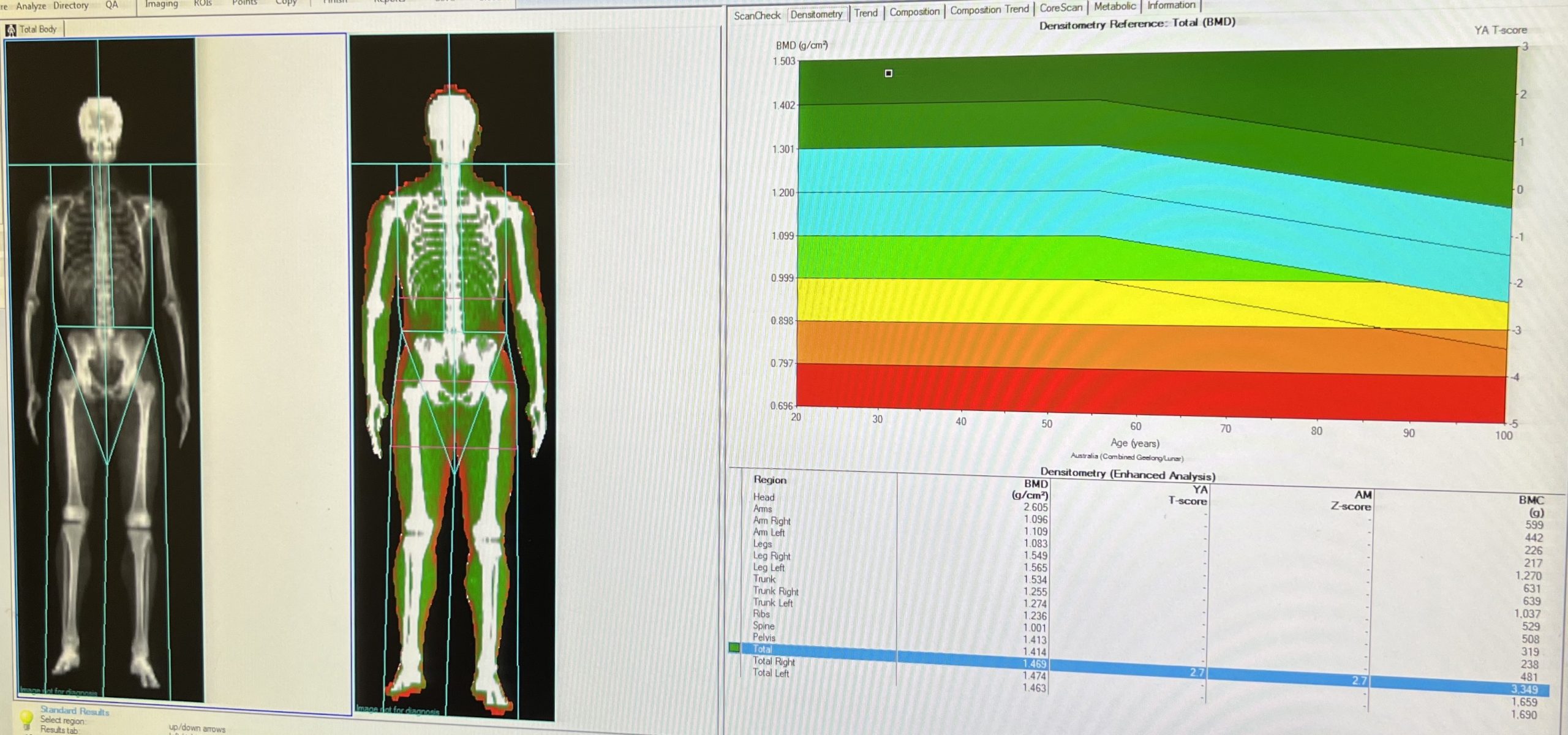 How Much Dexa Body Scan Costs And Is It Worth It? - Azure Medical